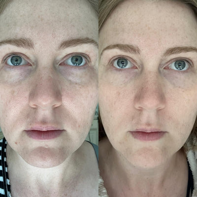 Customer photo